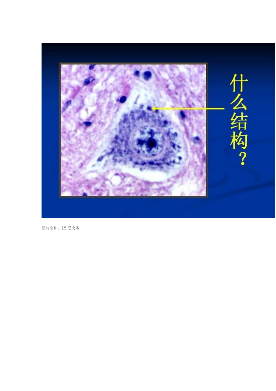 组胚实验考试图及答案.doc_第2页