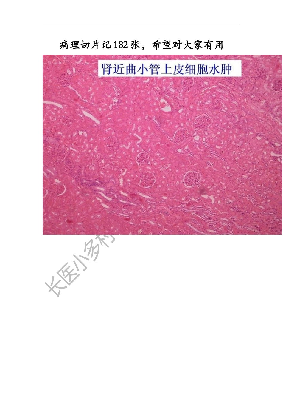 病理学切片182张.docx_第1页
