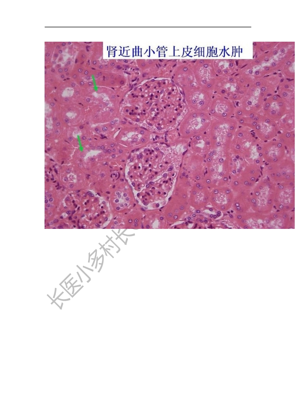 病理学切片182张.docx_第2页