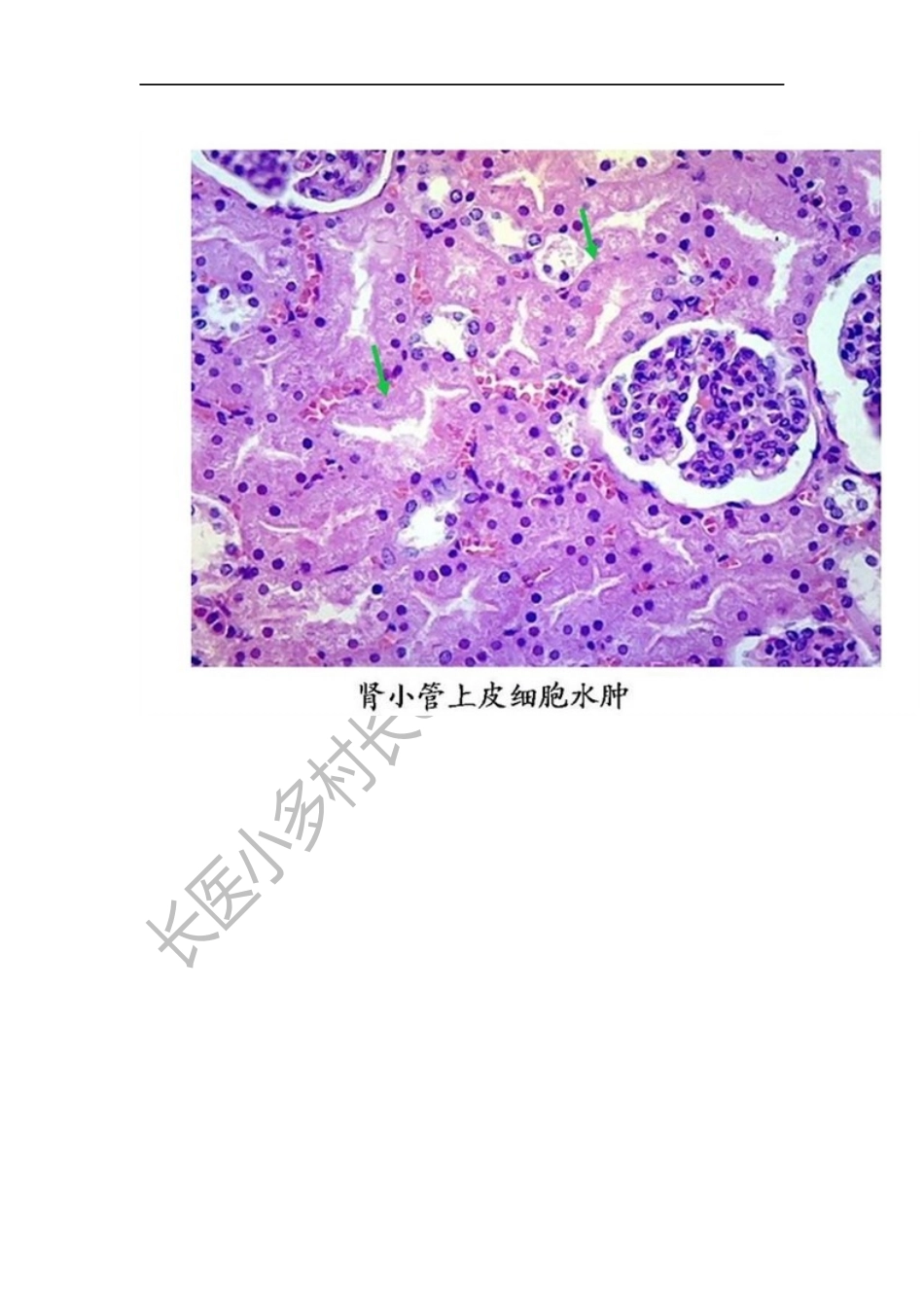 病理学切片182张.docx_第3页
