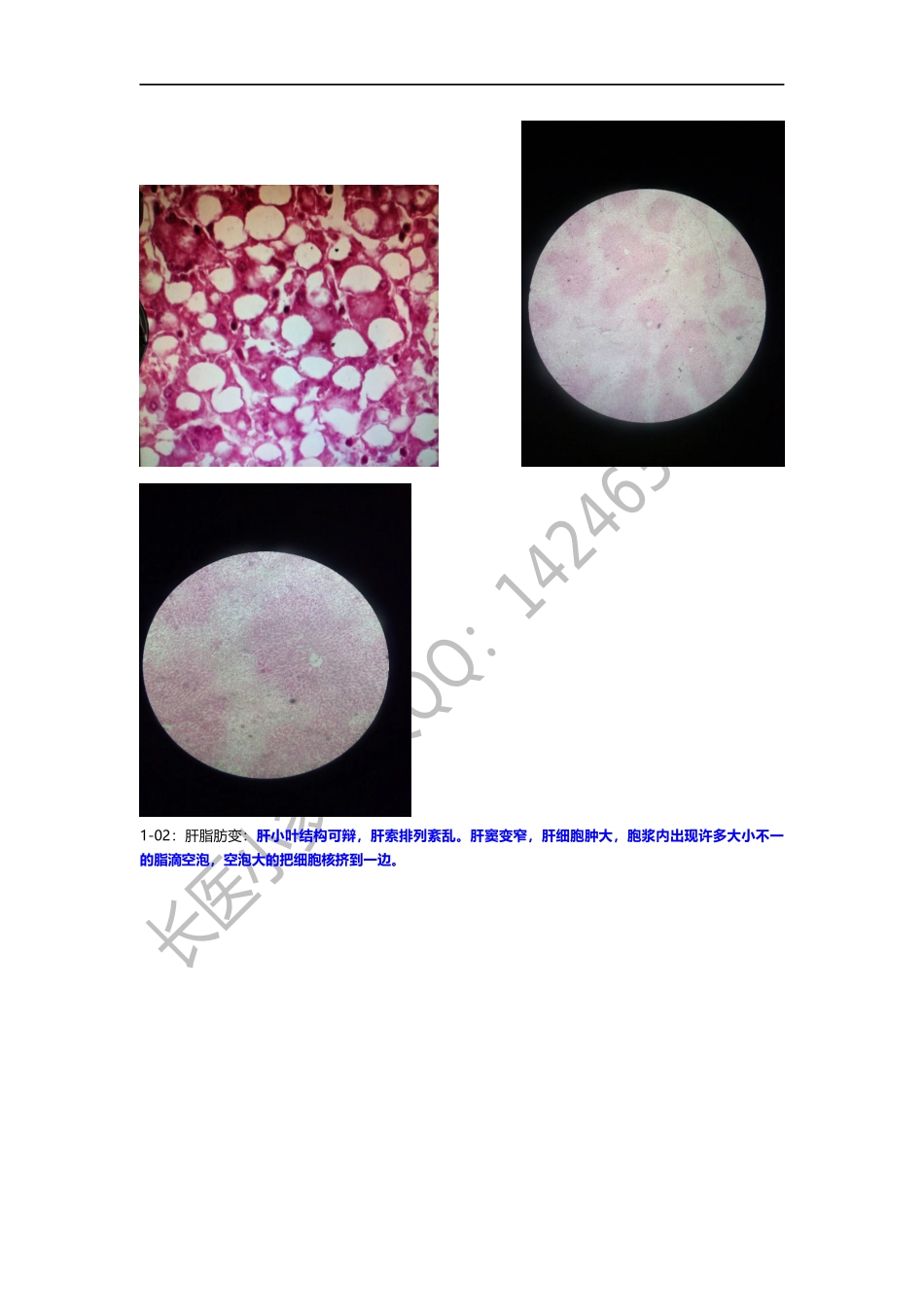 病理学切片复习.docx_第1页