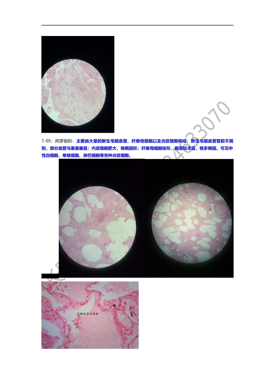 病理学切片复习.docx_第3页