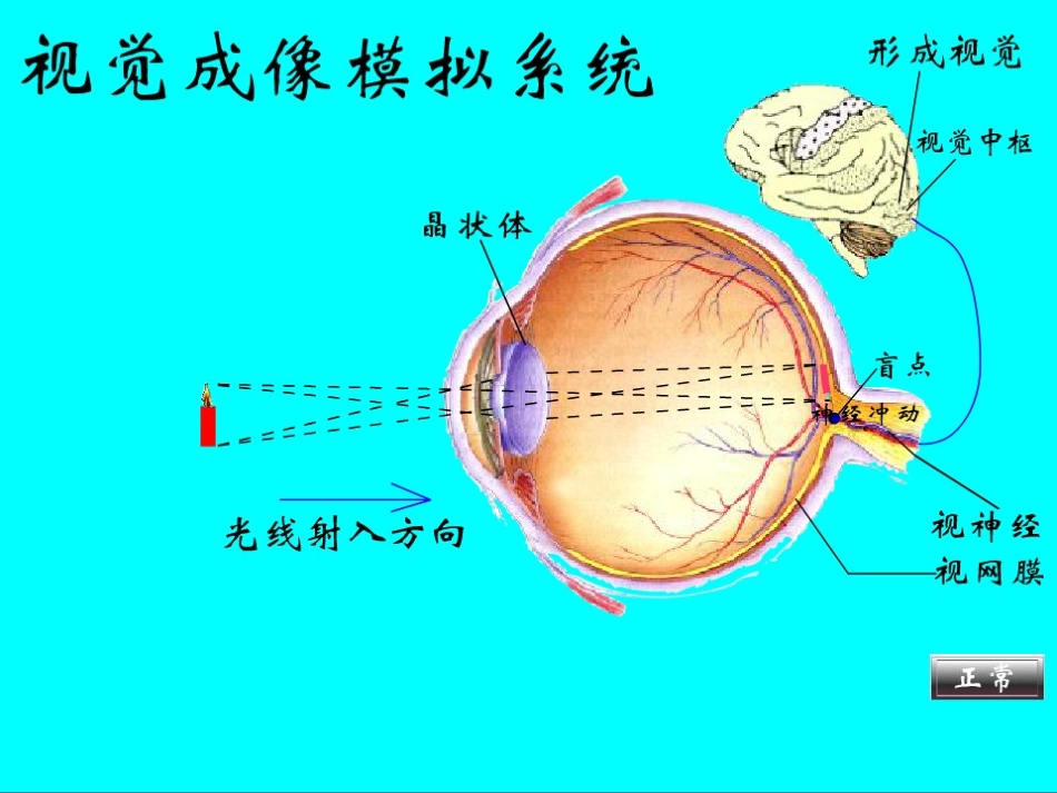 世界爱眼日ppt.ppt_第3页