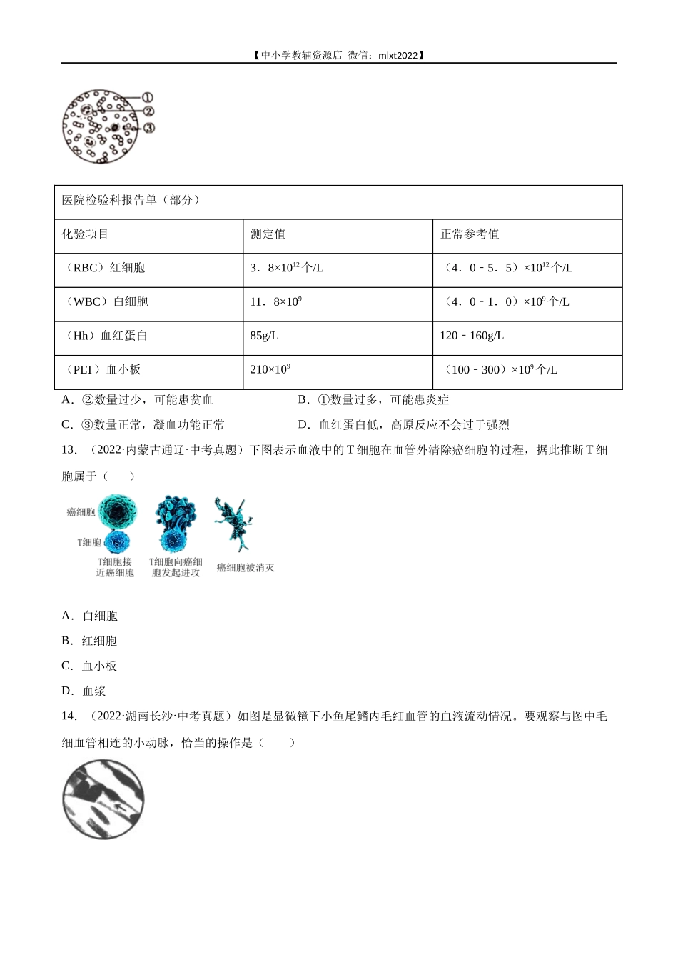 专题06 人体内物质运输和废物排出-2022年中考生物真题分项汇编（全国通用）（第4期）（原卷版）.docx_第3页