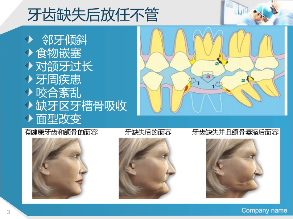 112.种植牙讲座ppt演讲稿.pptx_第3页