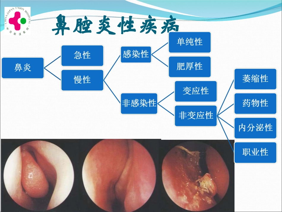 1)2011级临床口腔-慢性鼻炎变应性鼻炎鼻息肉-教室.ppt_第2页