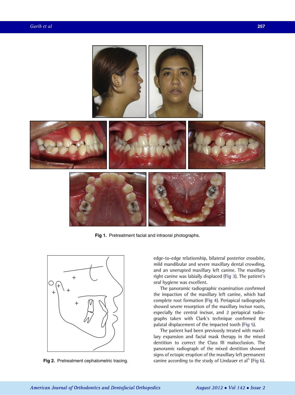 1-s2.0-S0889540612004143-main.pdf_第2页