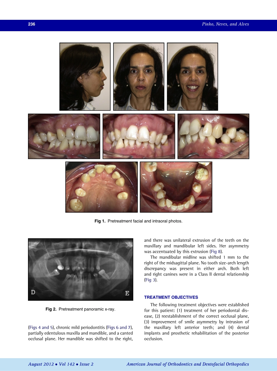 1-s2.0-S0889540612004155-main.pdf_第2页