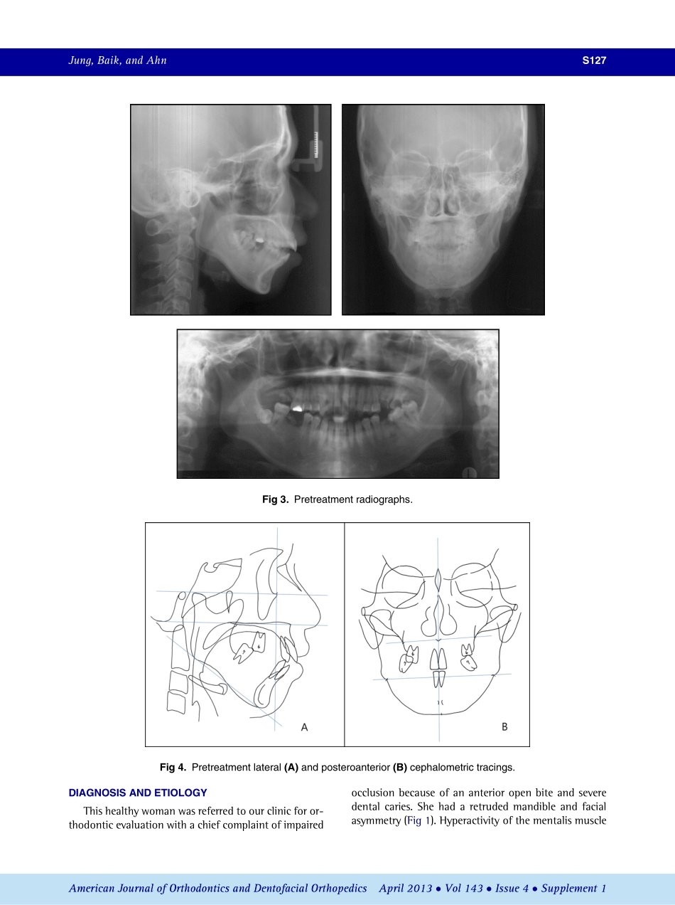 1-s2.0-S0889540612008700-main.pdf_第3页