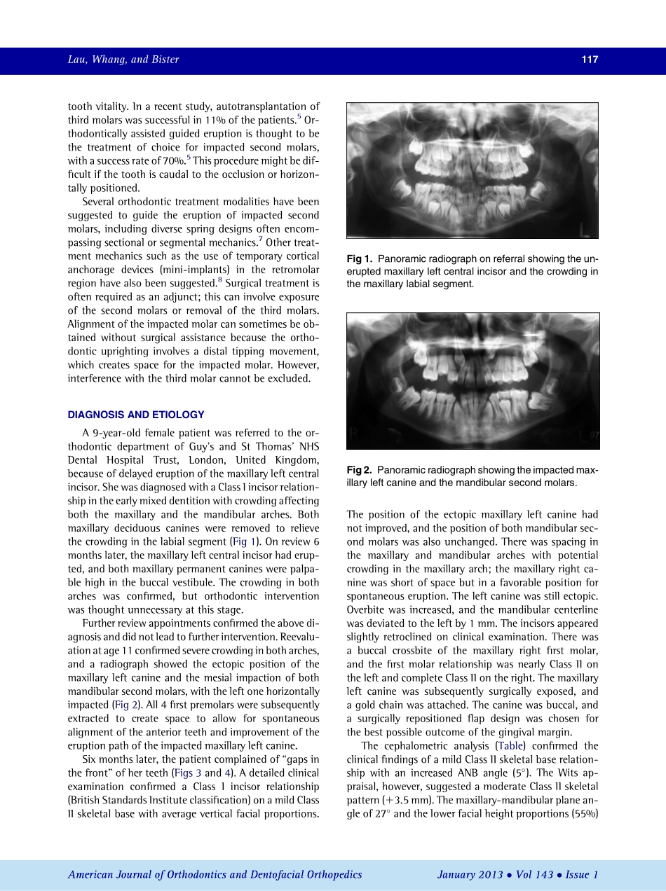 1-s2.0-S0889540612009080-main.pdf_第2页