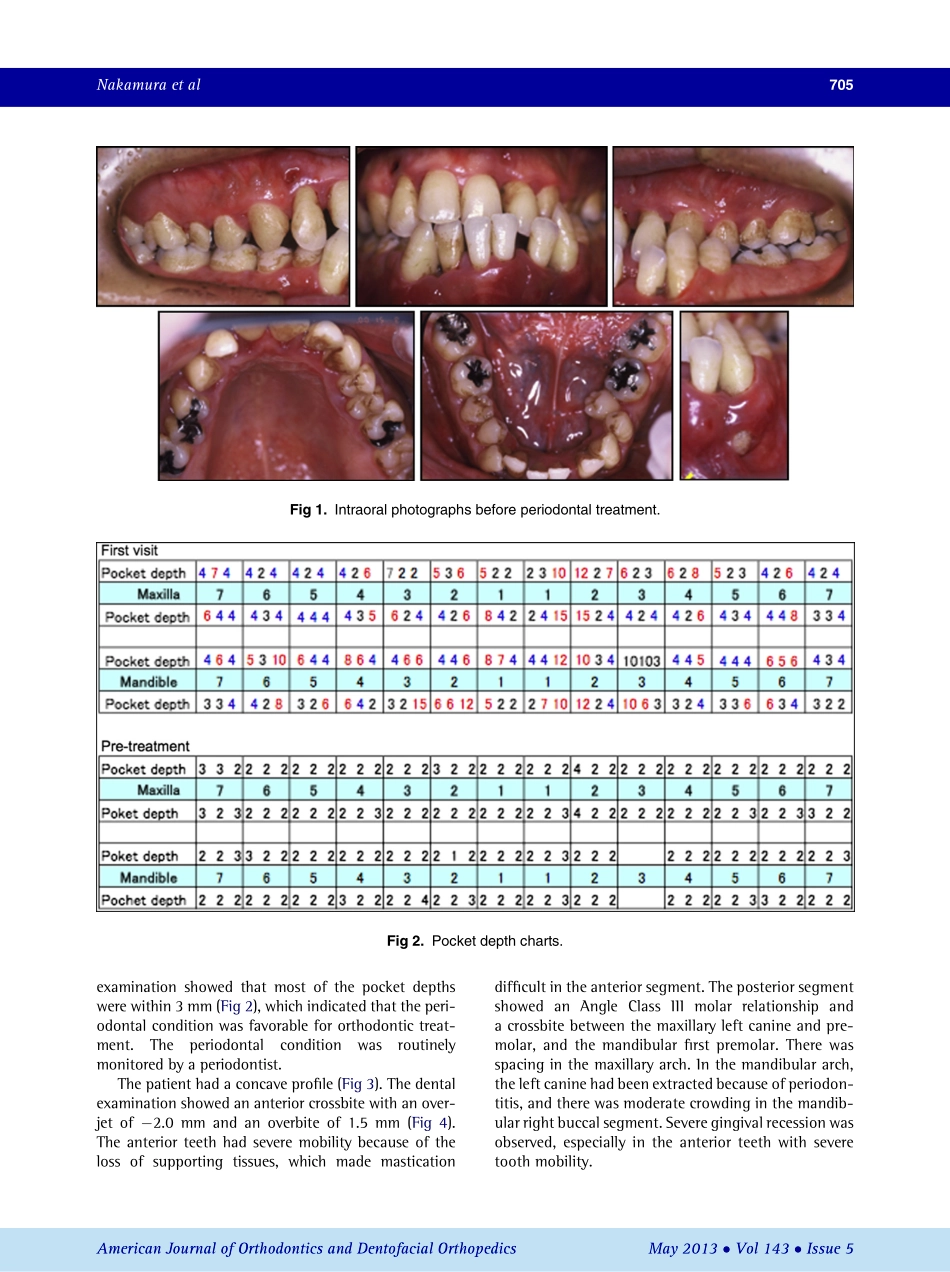 1-s2.0-S0889540613000759-main.pdf_第2页