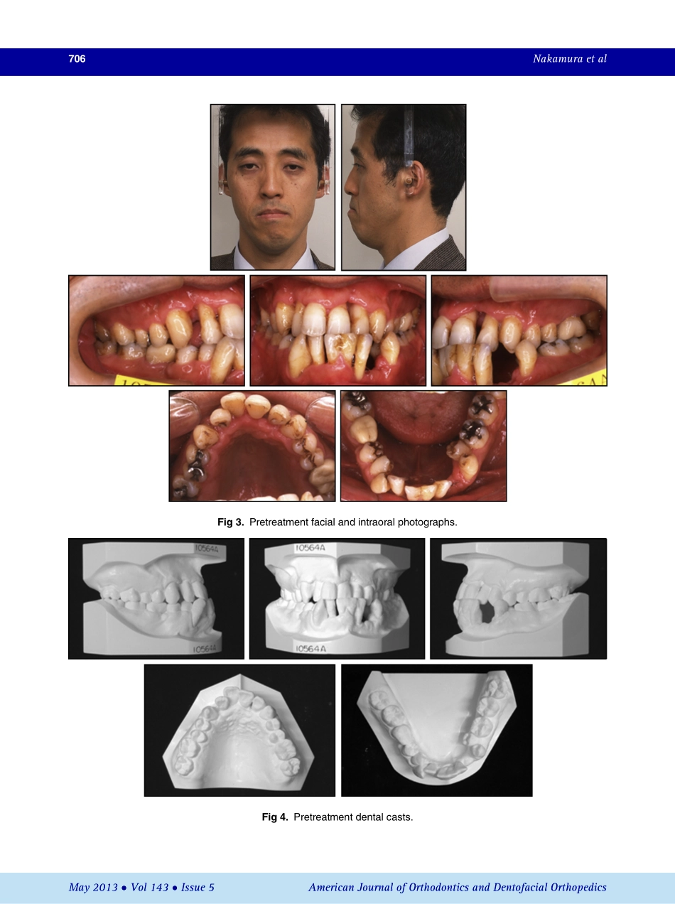 1-s2.0-S0889540613000759-main.pdf_第3页