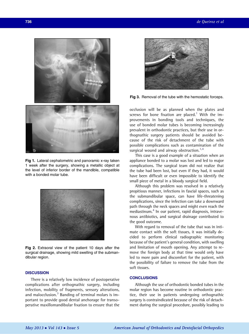 1-s2.0-S0889540613000905-main.pdf_第2页