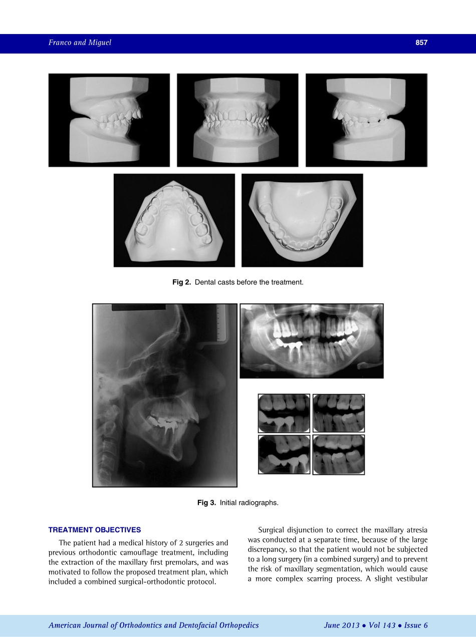 1-s2.0-S0889540613001649-main.pdf_第3页