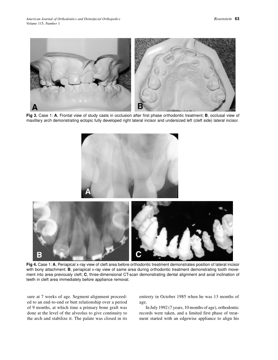 1999_115_1_61_71_Rosenstein.pdf_第3页