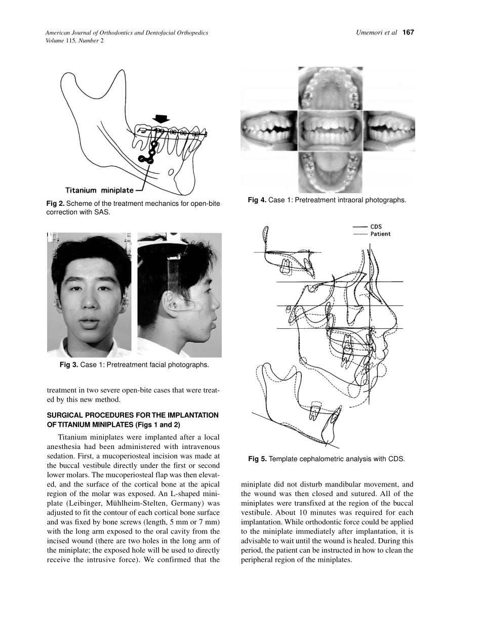 1999_115_2_166_174_Umemori.pdf_第2页