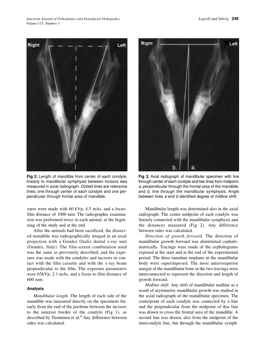 1999_115_3_247_253_Legrell.pdf_第3页