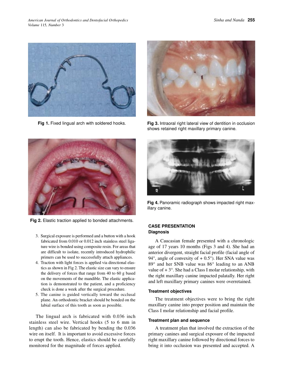 1999_115_3_254_257_Sinha.pdf_第2页