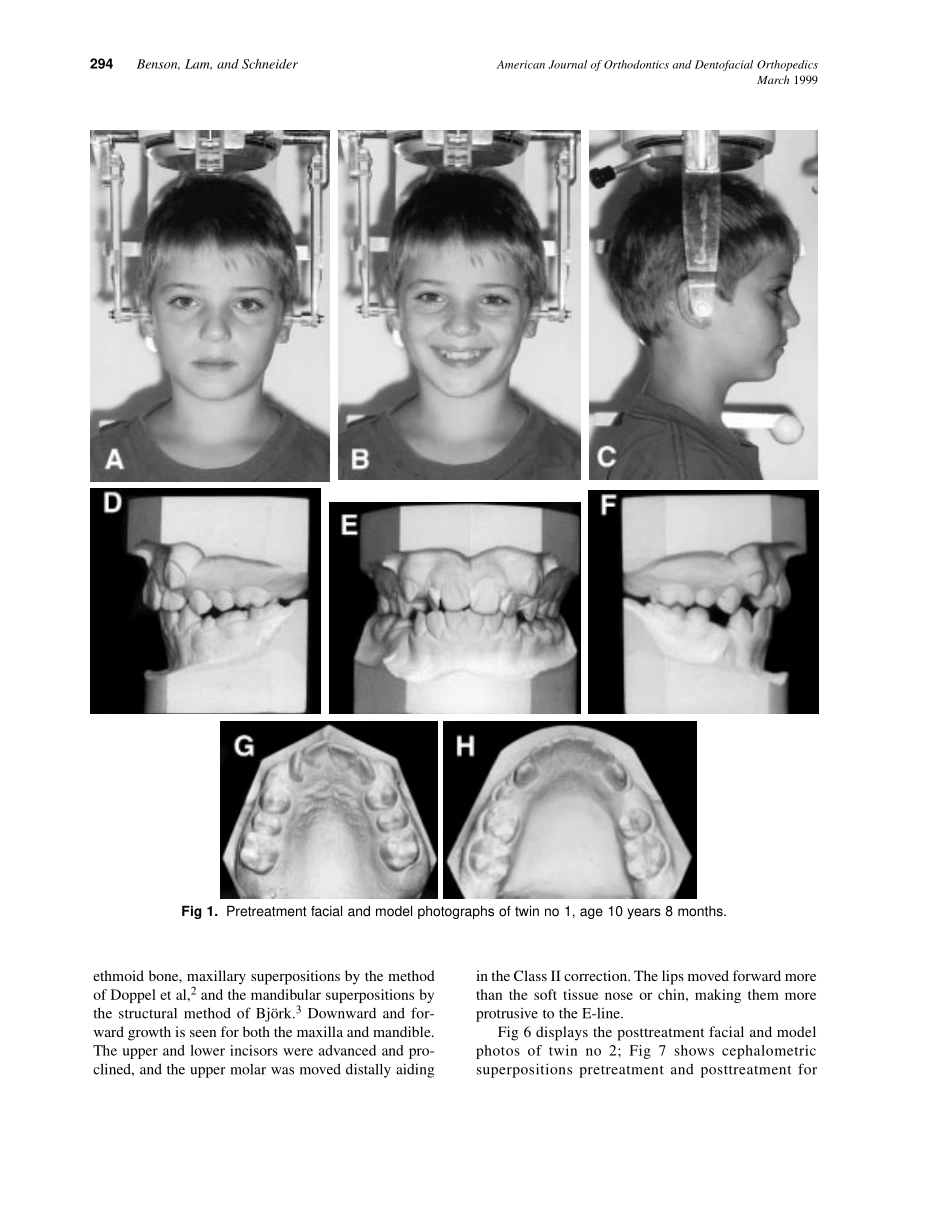 1999_115_3_293_299_Benson.pdf_第2页
