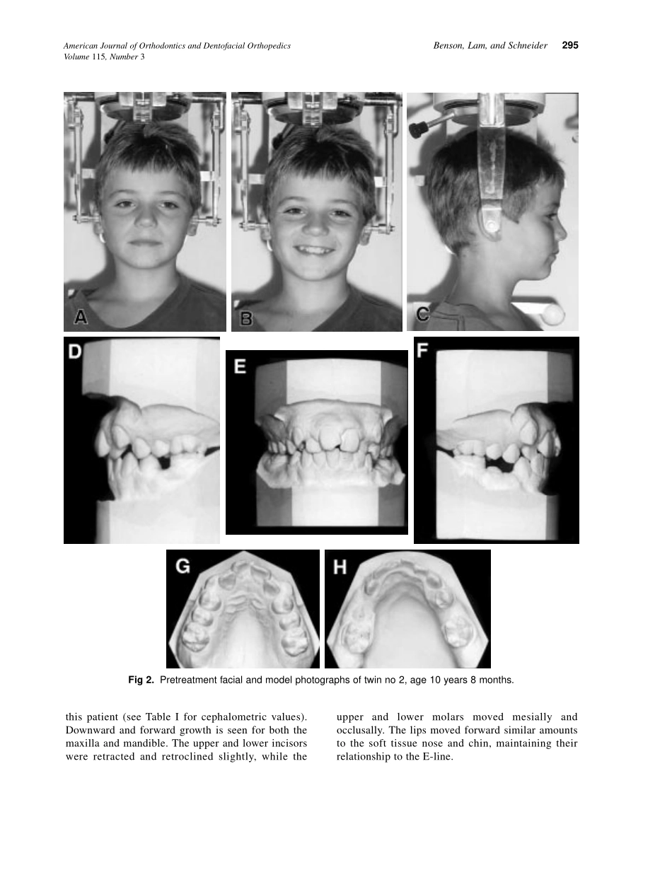 1999_115_3_293_299_Benson.pdf_第3页