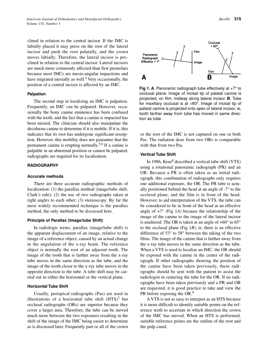 1999_115_3_314_322_Jacobs.pdf_第2页