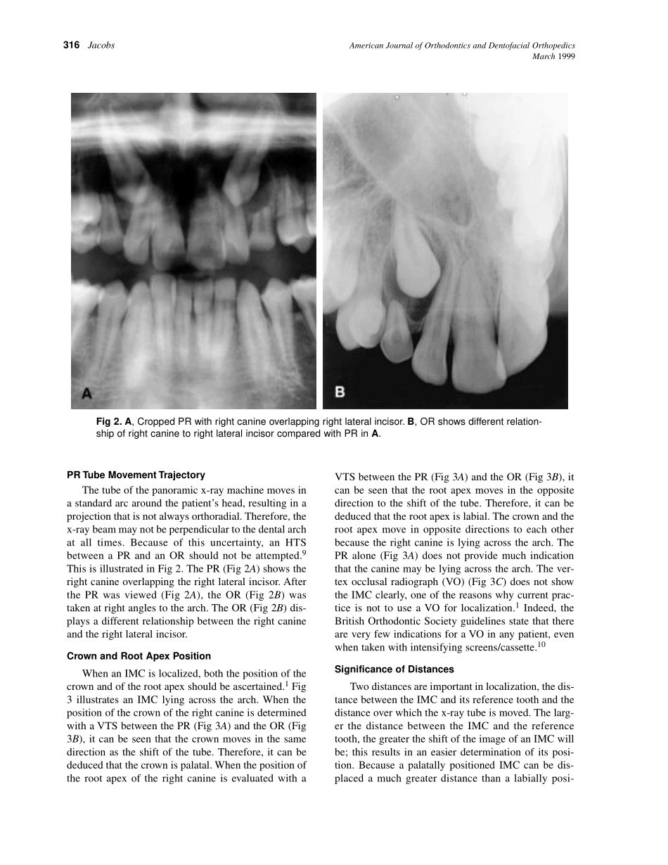 1999_115_3_314_322_Jacobs.pdf_第3页