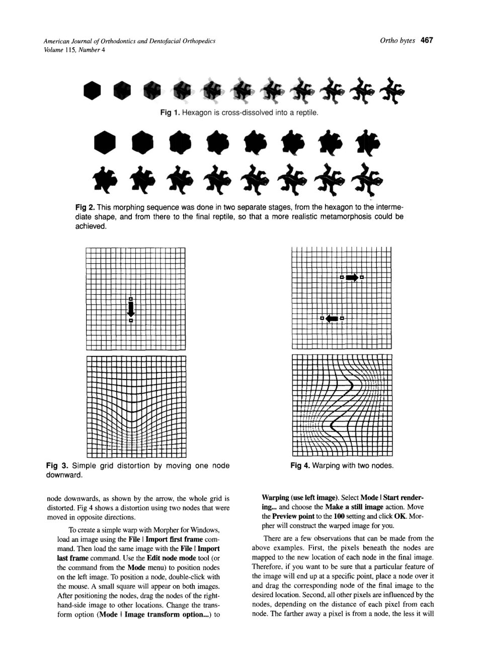 1999_115_4_466_470_Halazonetis.pdf_第2页