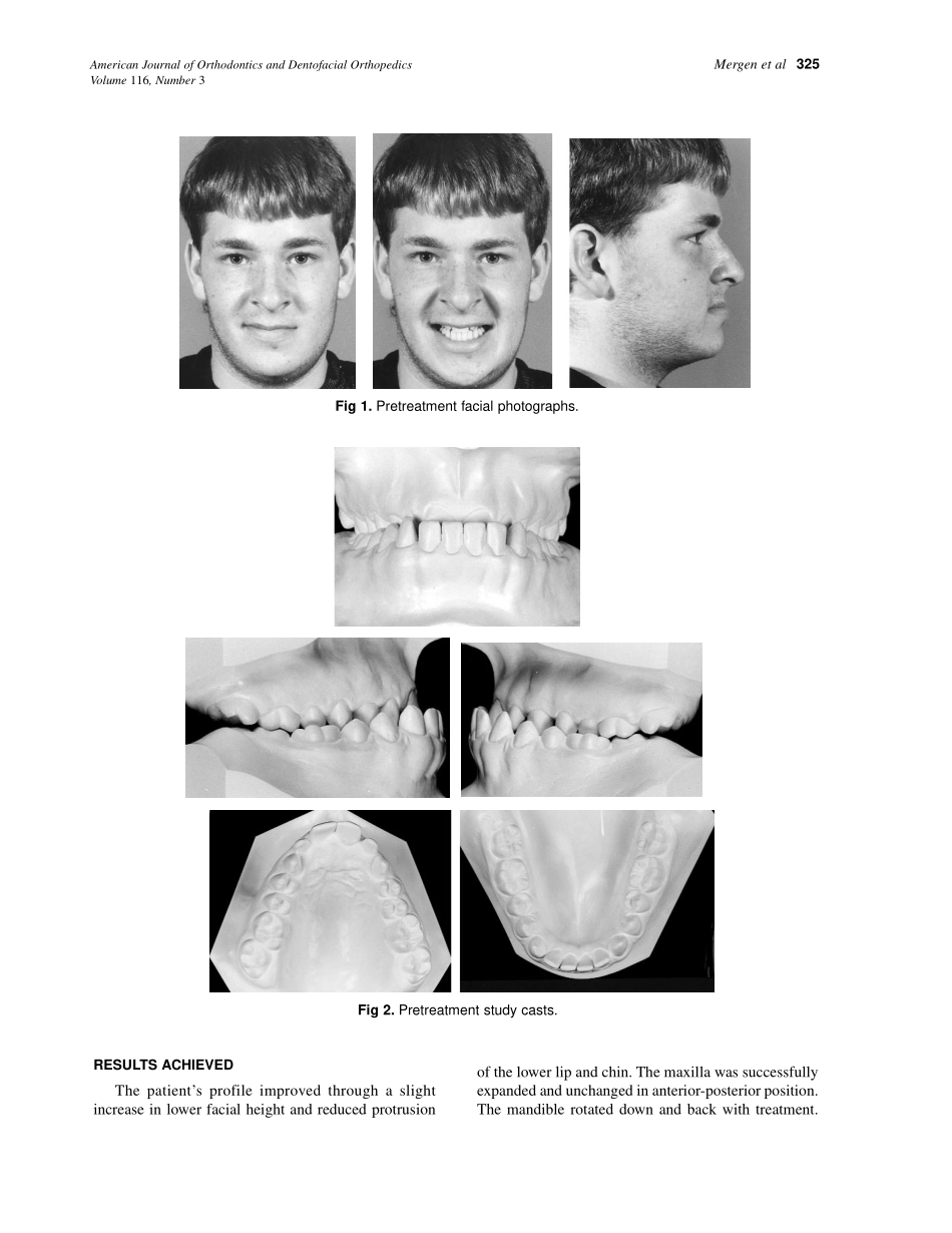 1999_116_3_324_328_Mergen_by_OrTHoTaMiNe.pdf_第2页