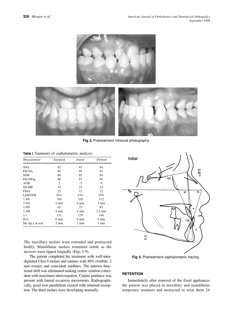 1999_116_3_324_328_Mergen_by_OrTHoTaMiNe.pdf_第3页