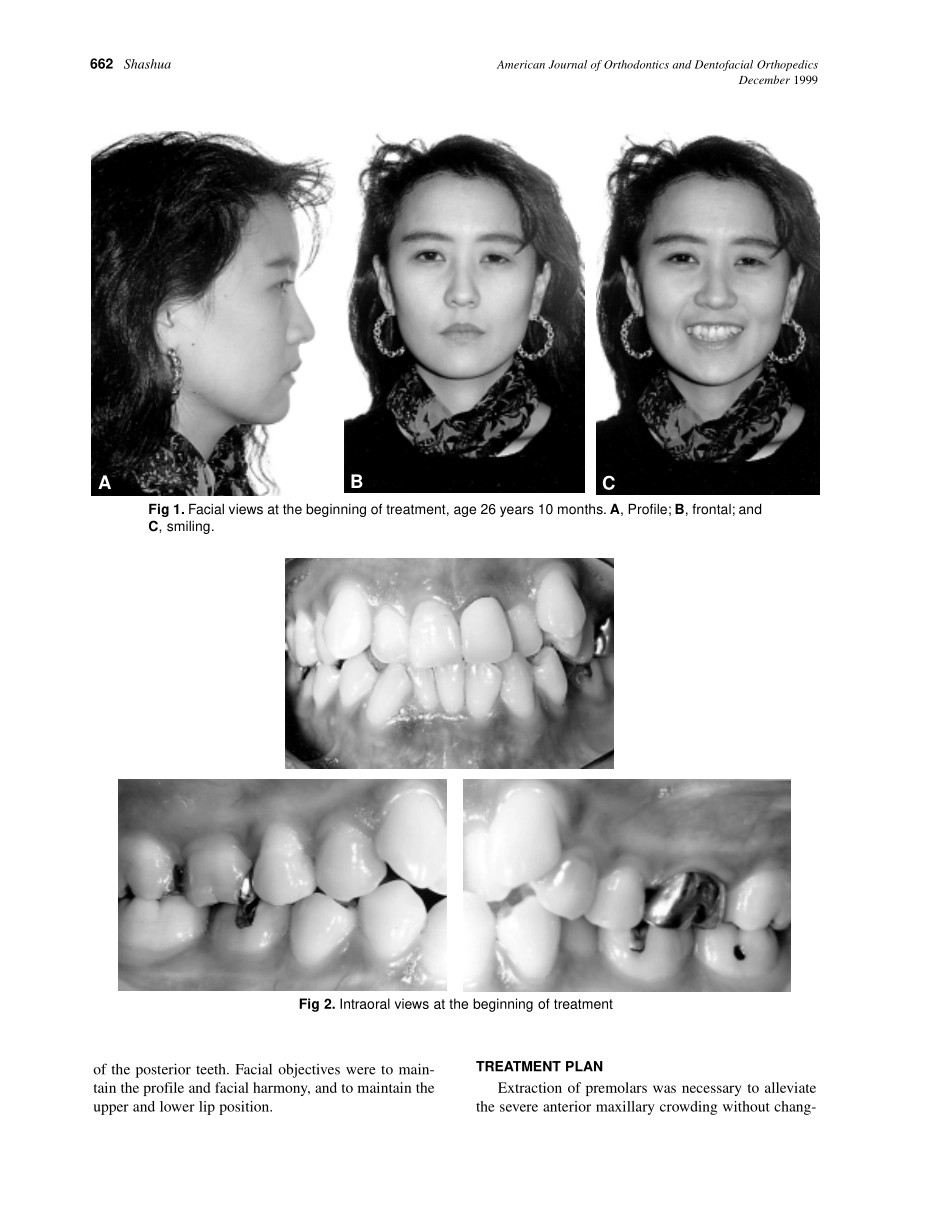 1999_116_6_661_666_Shashua_by_OrTHoTaMiNe.pdf_第2页