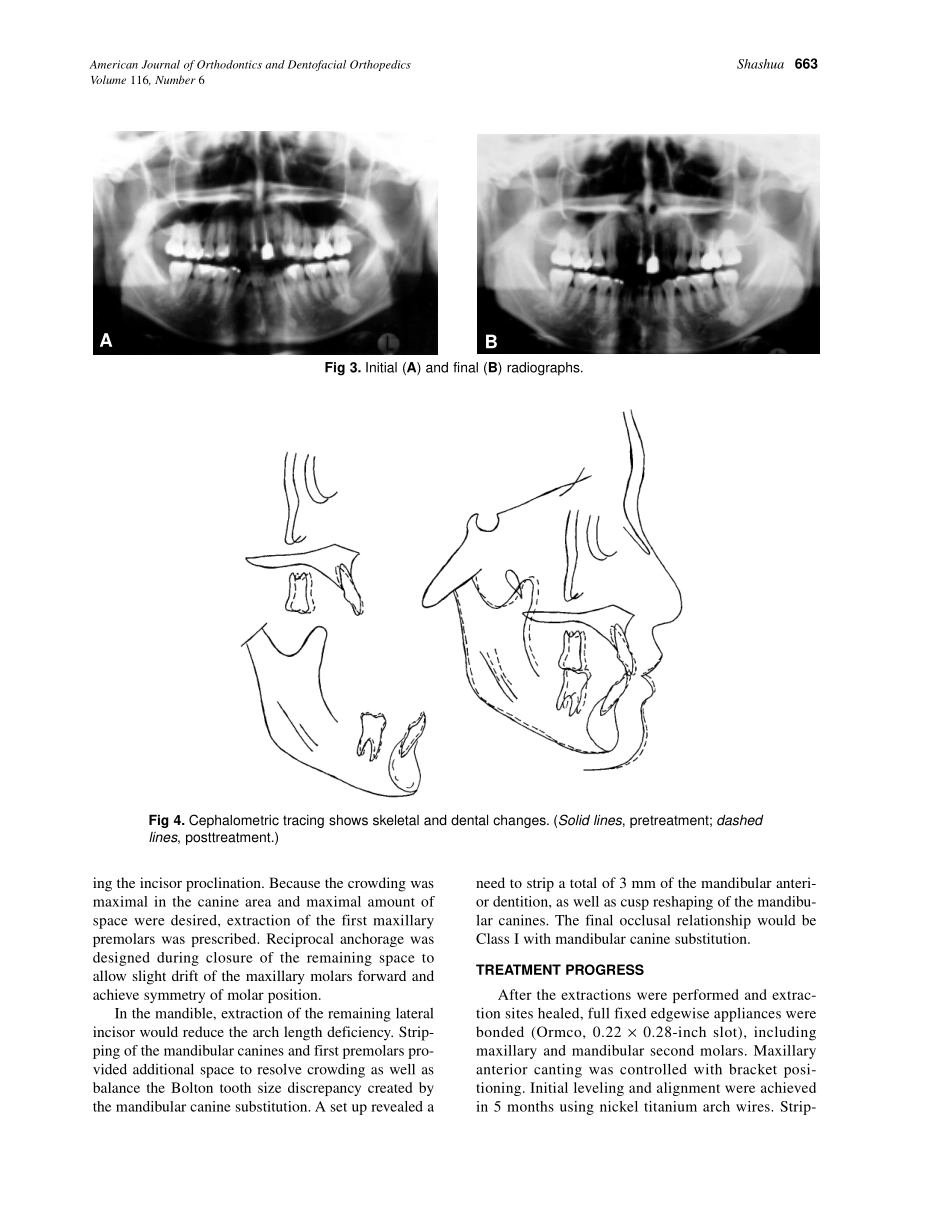 1999_116_6_661_666_Shashua_by_OrTHoTaMiNe.pdf_第3页