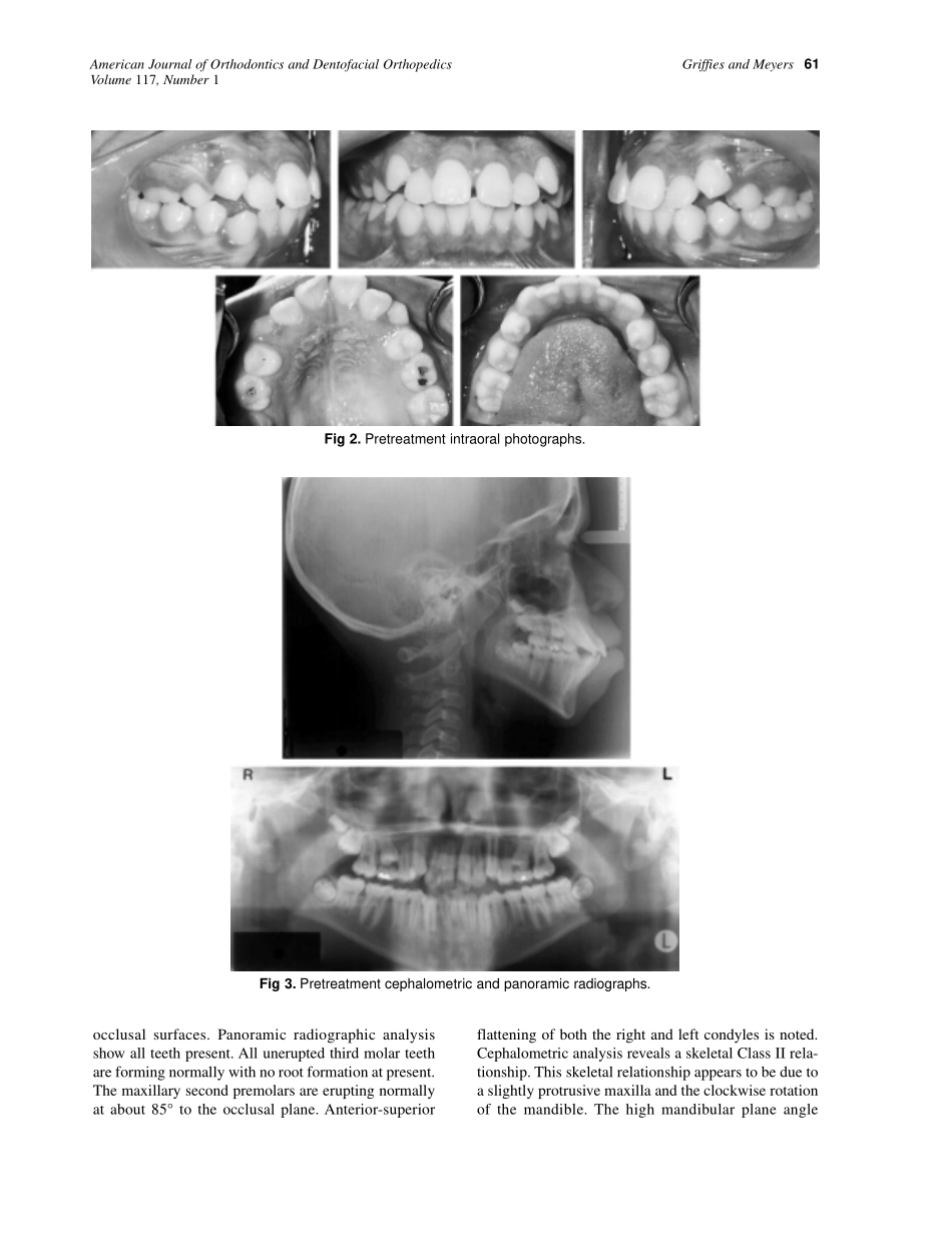 2000_117_1_60_67_Griffies.pdf_第2页