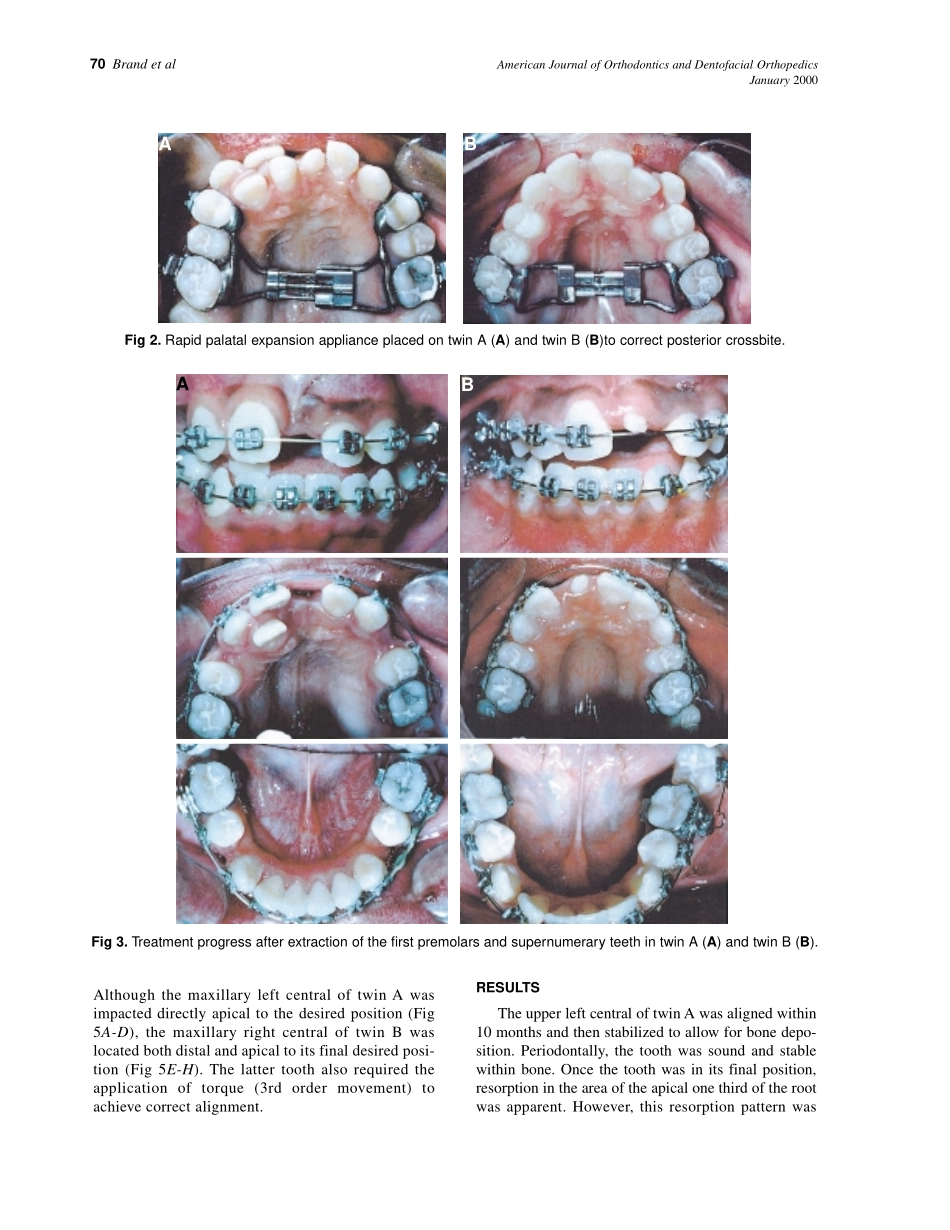 2000_117_1_68_74_Brand.pdf_第3页