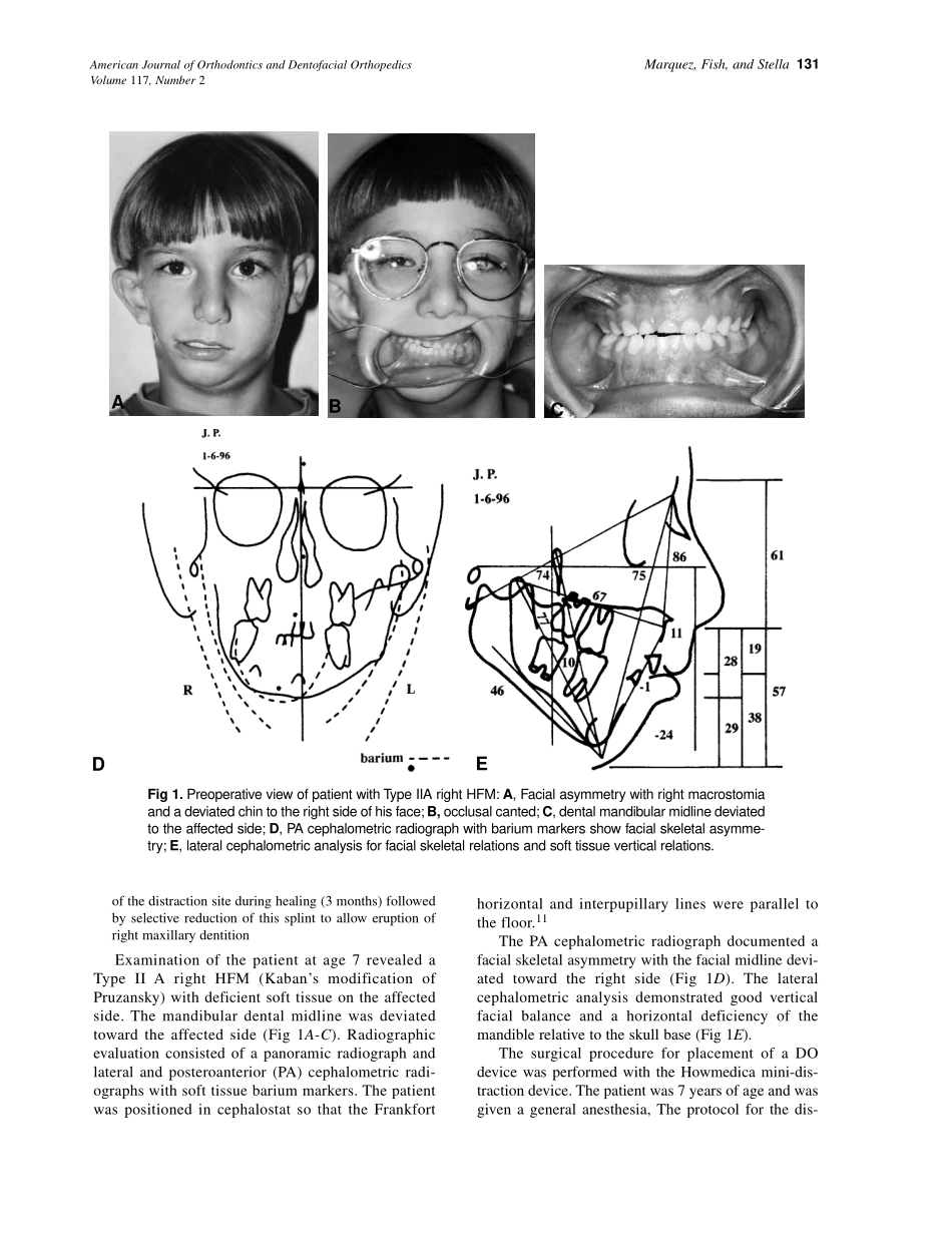 2000_117_2_130_139_Marquez.pdf_第2页