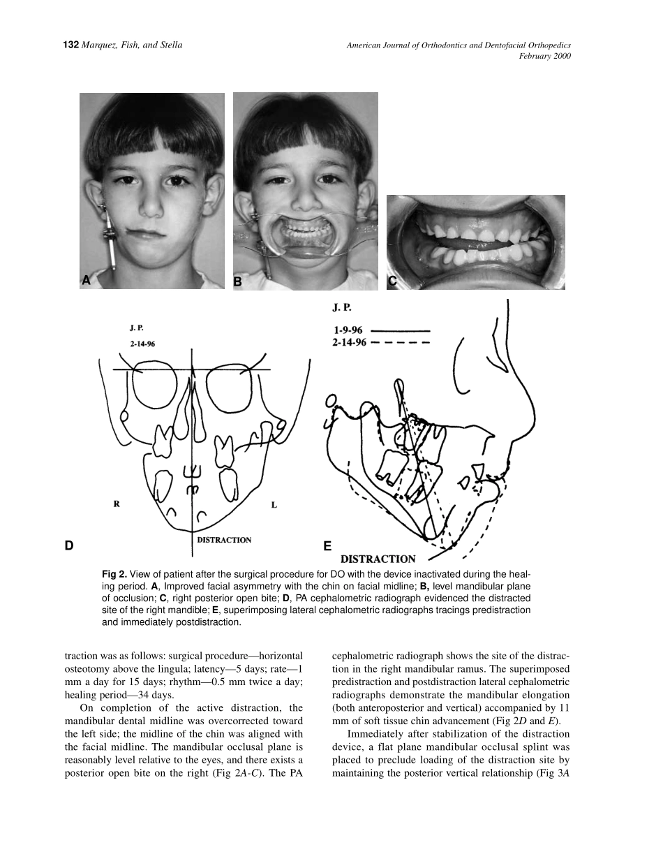 2000_117_2_130_139_Marquez.pdf_第3页