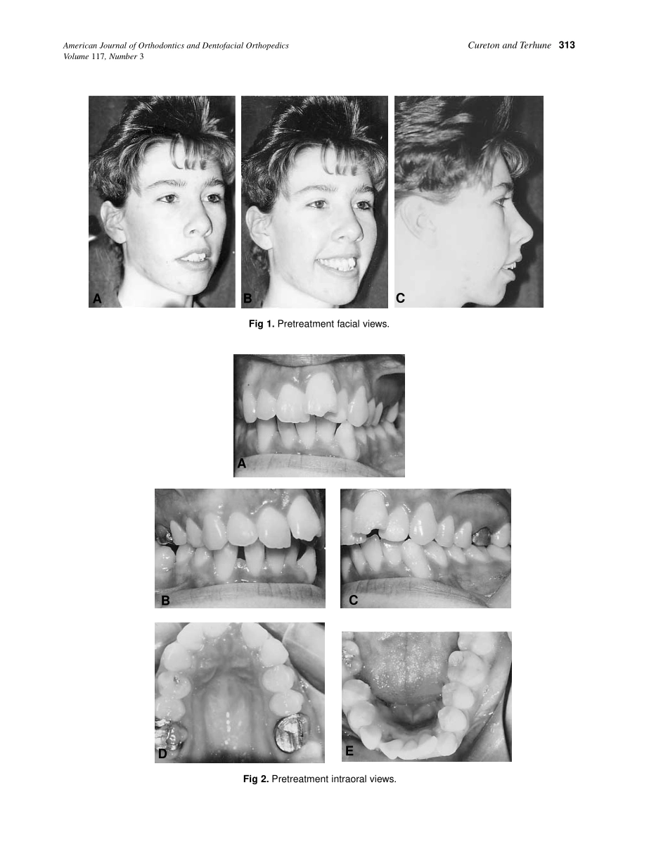 2000_117_3_312_319_Cureton.pdf_第2页