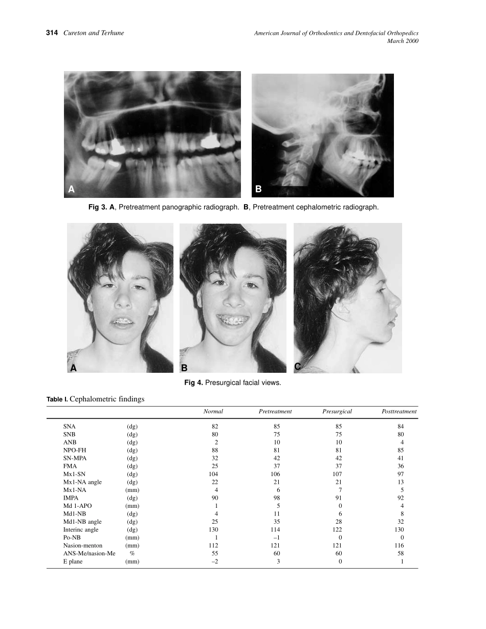2000_117_3_312_319_Cureton.pdf_第3页