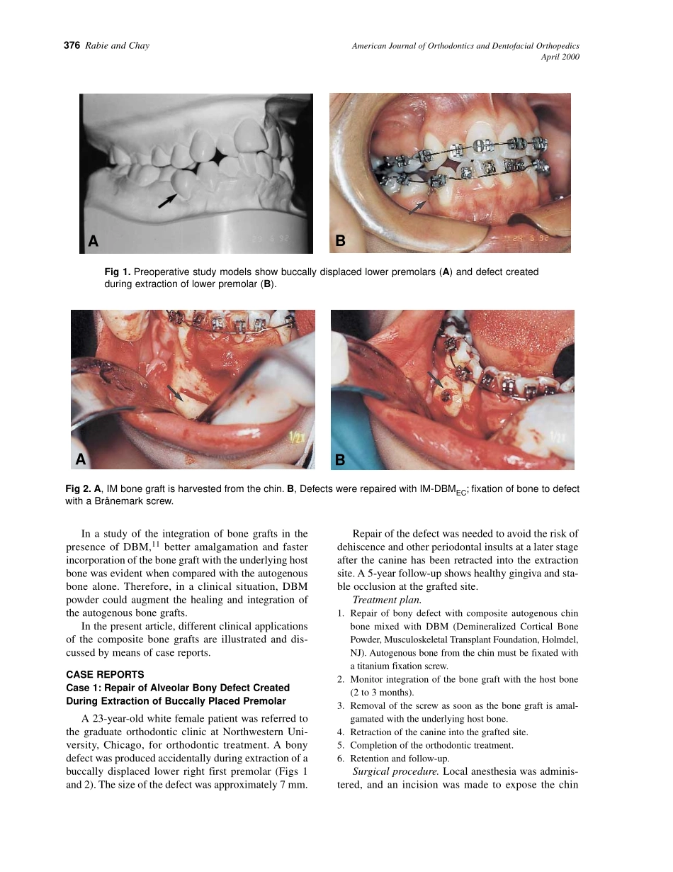 2000_117_4_375_383_Rabie.pdf_第2页