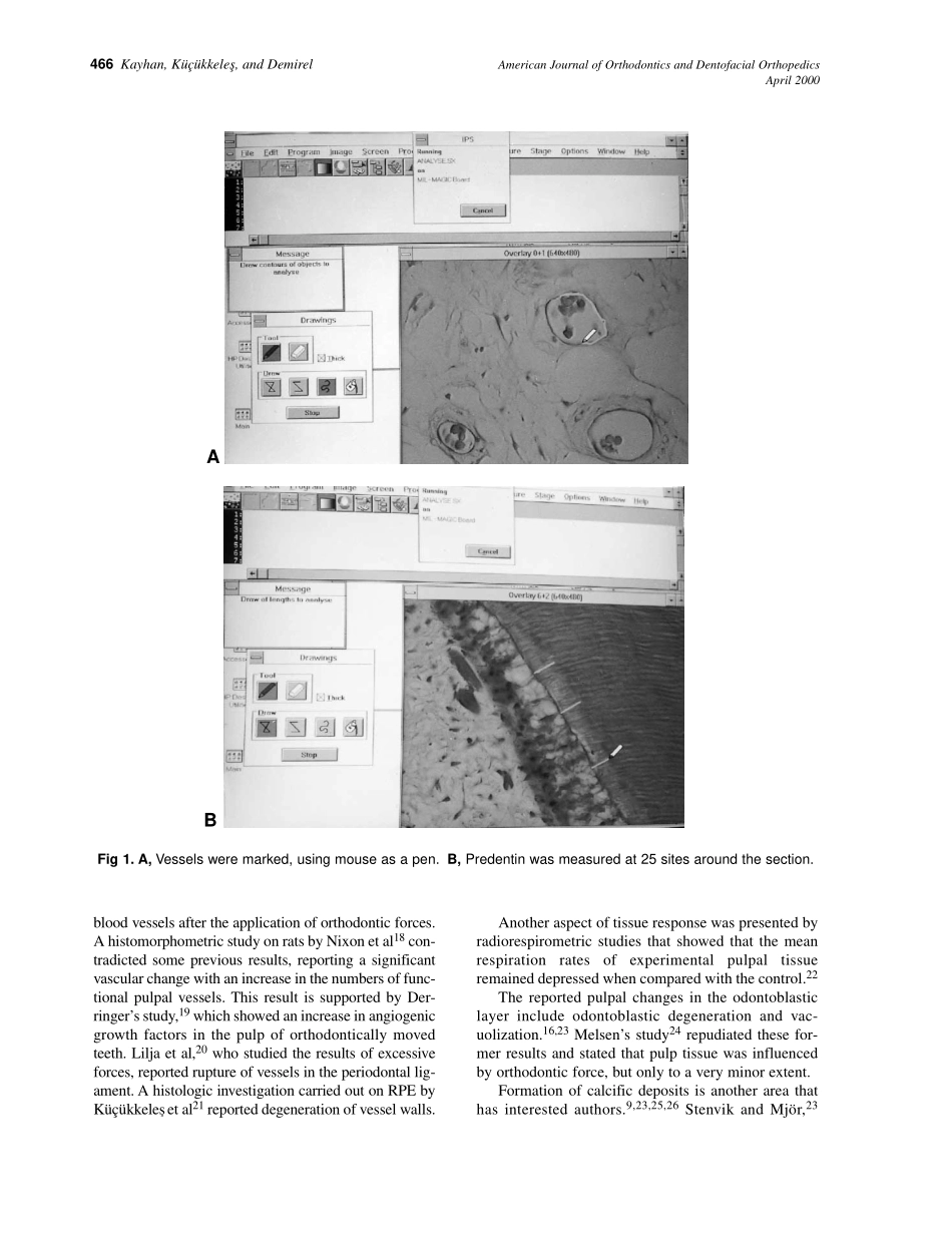 2000_117_4_465_473_Kayhan.pdf_第2页