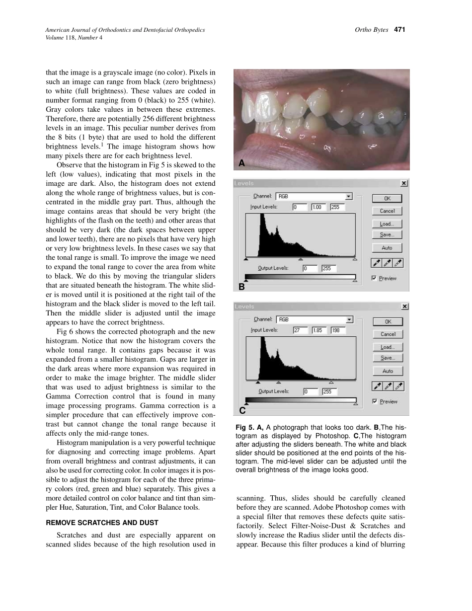 2000_118_4_469_475_Halazonetis.pdf_第3页