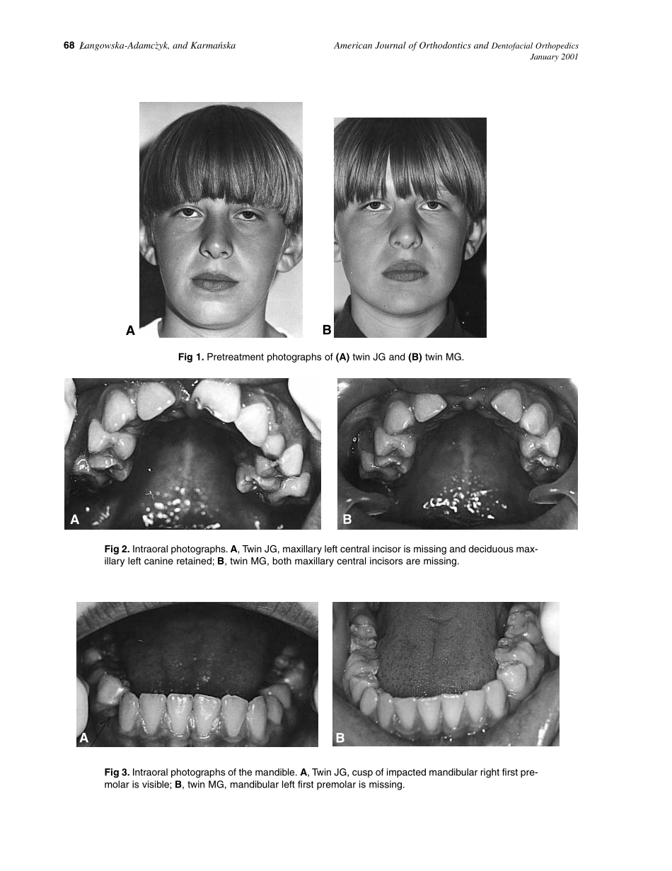 2001_119_1_67_70_Langowska-Adamczyk.pdf_第2页