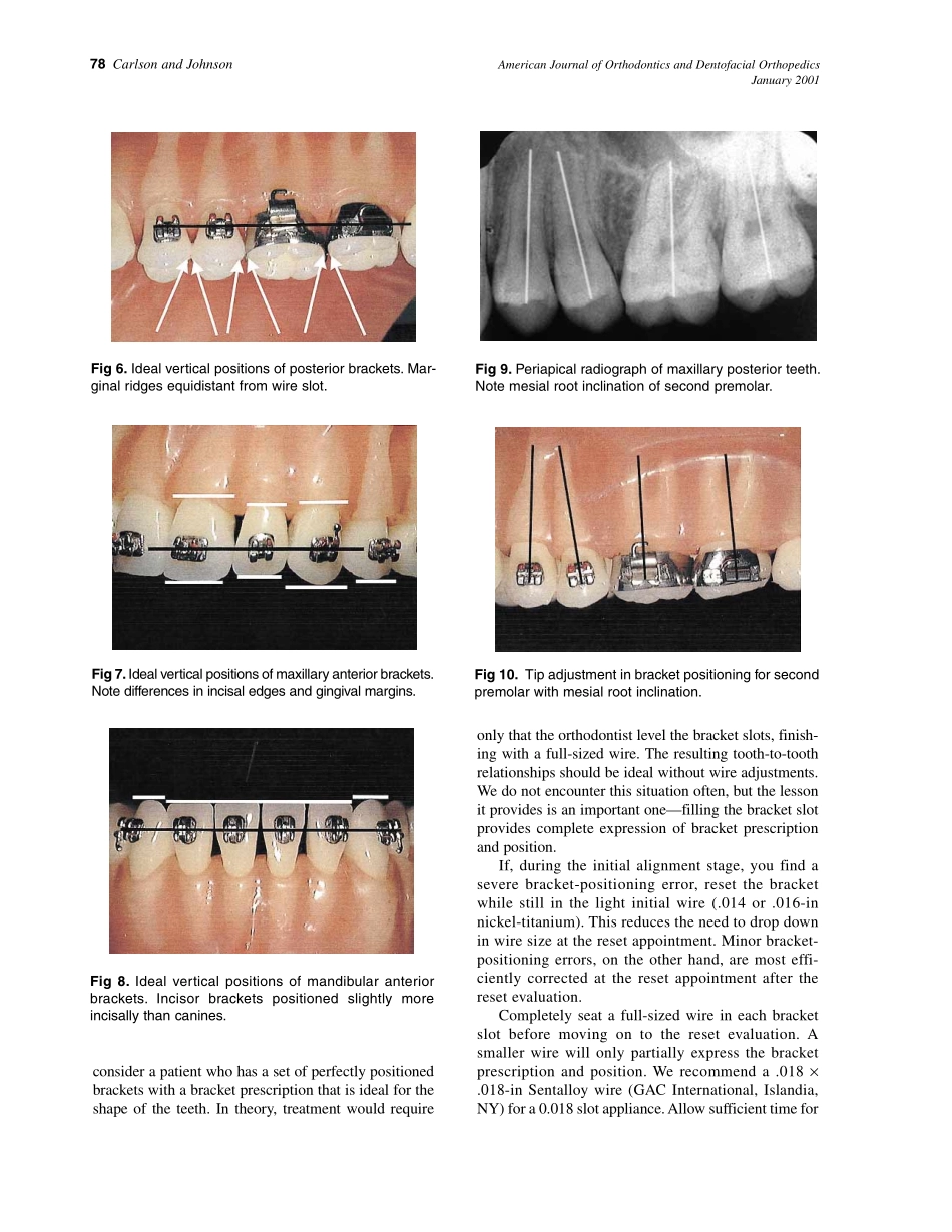 2001_119_1_76_80_Carlson.pdf_第3页