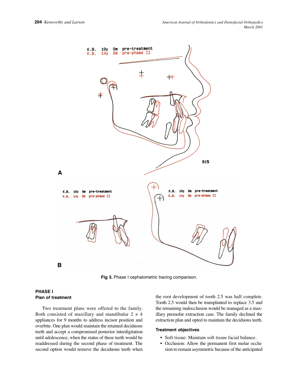 2001_119_3_202_210_Kenworthy.pdf_第3页