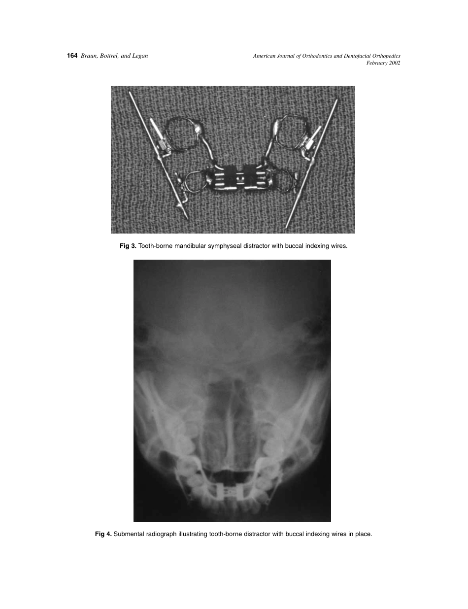 2002_121_2_162_165_Braun.pdf_第3页