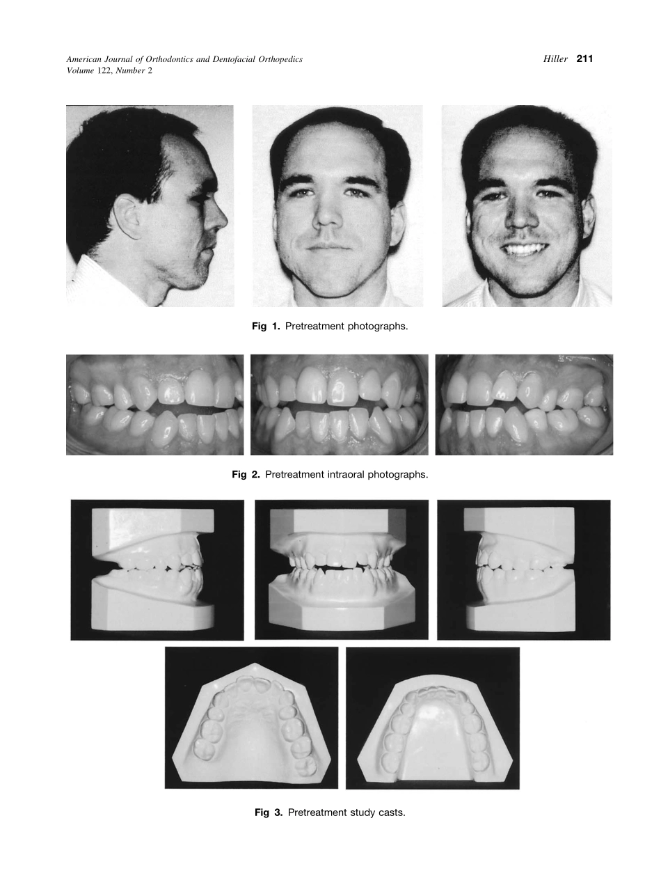 2002_122_2_210_216_Hiller.pdf_第2页