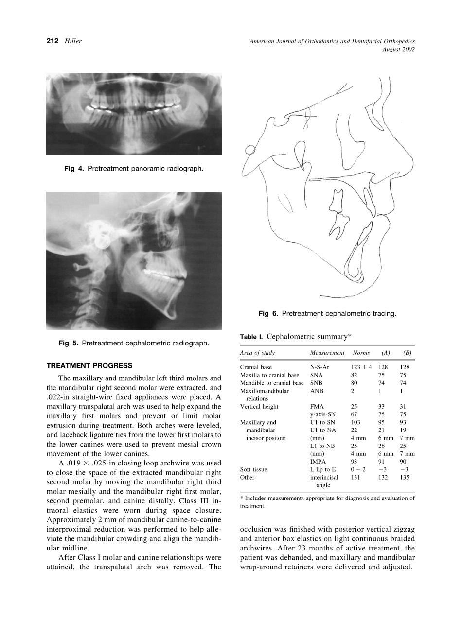 2002_122_2_210_216_Hiller.pdf_第3页