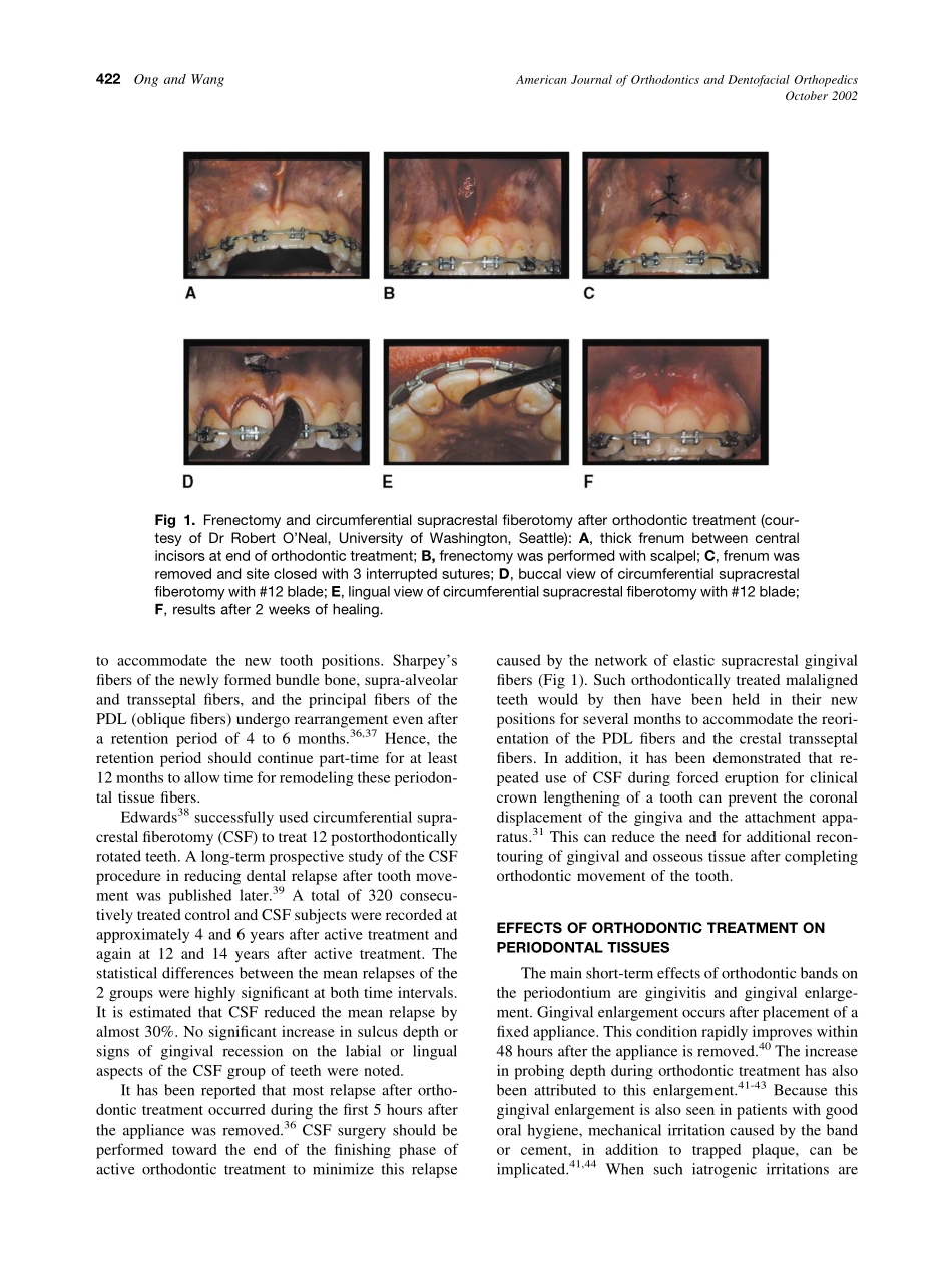 2002_122_4_420_428_Ong.pdf_第3页