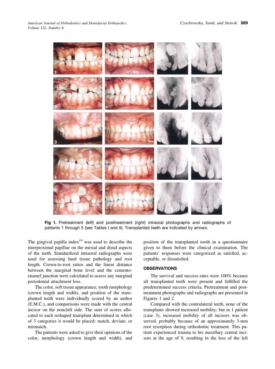 2002_122_6_587_592_Czochrowska.pdf_第3页