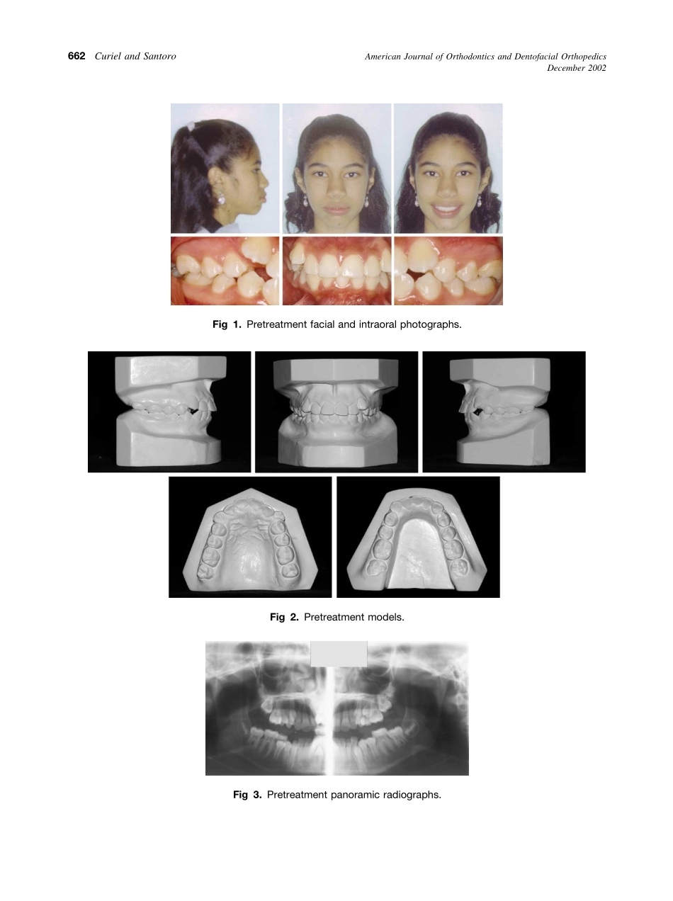 2002_122_6_661_665_Curiel.pdf_第2页