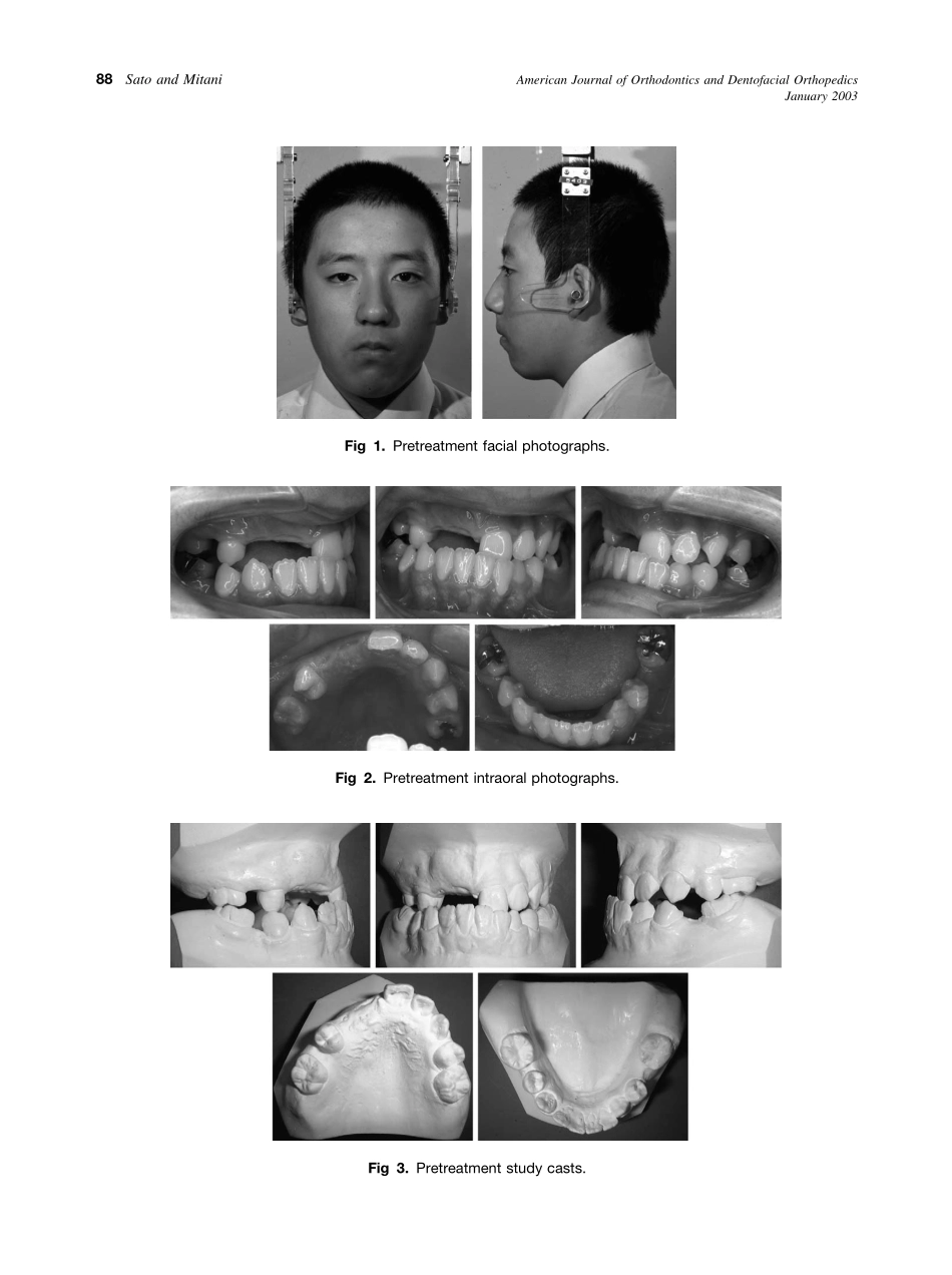 2003_123_1_87_92_Sato.pdf_第2页